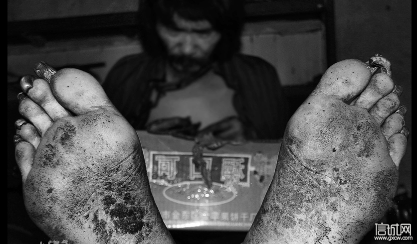 解锁前的精神病人